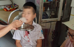 Học sinh lớp 1 bị hành hung dã man ở Hòa Bình: Đã khởi tố vụ án