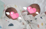 "Cuộc chiến" giành sự sống cho 2 bé sinh non lúc 25 tuần