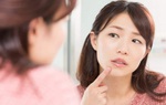 5 cách trị mụn ẩn trên trán tại nhà giúp nhân tự trồi lên không cần nặn