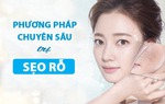 90% sẹo rỗ có thể chữa khỏi bằng những phương pháp chữa trị chuyên sâu
