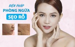 Tuyệt đối không được làm những điều sau để "né" sẹo rỗ