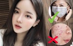 Đeo khẩu trang cầm chắc bị mụn, làm thế nào phòng tránh?