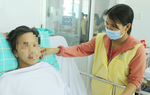 Bệnh nhân bị rắn hổ mang chúa cắn: Có những lúc đã ngấp nghé cửa tử