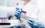 Phát hiện kháng thể vô hiệu hóa virus gây Covid-19