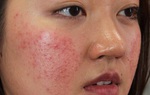 5 quy tắc sử dụng mỹ phẩm an toàn, không gây hại cho da