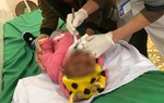 Đốt than củi sưởi ấm những ngày giá rét, 2 trẻ bị bỏng mặt