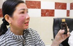 Rước họa vì dùng mỹ phẩm làm trắng da cấp tốc đón tết
