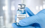 Các câu hỏi thường gặp về tiêm vaccine phòng bệnh thủy đậu