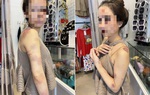Vụ người vợ bị chồng đánh đập dã man ở Yên Bái: Hội LHPN tỉnh đề nghị xử lý nghiêm