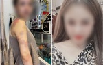 Người chồng bị vợ tố bạo hành ở Yên Bái: "Đúng là tôi có đánh vợ nhưng không nhốt"