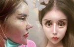 Người phụ nữ trẻ gây hoang mang vì phẫu thuật thẩm mỹ quá đà