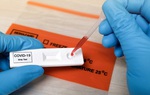 Chuyên gia lý giải vì sao giá test xét nghiệm Covid-19 khác nhau