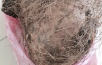 Bộ Y tế tìm ra chất gây ngộ độc trong loại củ rừng khiến 7 người cấp cứu