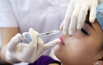 Tiêm filler ở spa, cô gái 25 tuổi bị hoại tử mũi và trán 