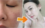 "Đại sứ chăm sóc da" chỉ 4 điều phải thay đổi ngay lập tức khi skincare mùa lạnh