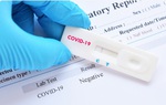 Tự test Covid-19 dương tính, người dân nên làm gì? 