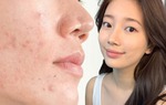 Dưỡng da bằng vitamin C: Bí quyết "cứu vớt" làn da thâm sạm, già nua nhưng sự thật ra sao?