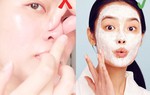 Bỏ ngay cách nặn thô bạo, 5 công thức mặt nạ trị mụn đầu đen sẽ giúp nàng làm đẹp