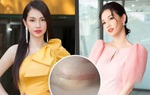 Hình ảnh mới nhất của MC Quỳnh Chi sau ca phẫu thuật vì tế bào ung thư xâm lấn