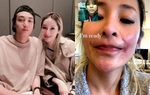 Diva Cbiz công khai vết sẹo bị chó cắn, tiết lộ chuyện 2 tháng sống với vết thương hoại tử