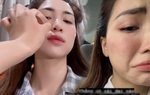 Hòa Minzy khóc ròng khi mặt bong tróc từng mảng nhăn nheo như bà già