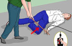 Nhiều tai nạn điện giật do câu cá, hướng dẫn sơ cứu khi bị bỏng điện