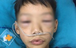 Uống thuốc tự mua, bé 10 tuổi ở Phú Thọ bị sốc phản vệ phải cấp cứu