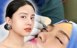 Sởn gai ốc trước hình ảnh những ca nhấn, cắt mí mắt thất bại 