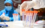 Bé 2 tuổi ở Hà Nam nhiễm Covid-19