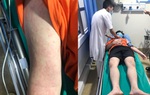 Nam thanh niên sốc phản vệ nguy kịch sau khi ăn con mối