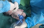 Phẫu thuật tại khu cách ly cứu mẹ con sản phụ bị bong rau non nguy kịch