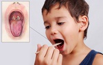 Thông tin từ A đến Z về bệnh bạch hầu