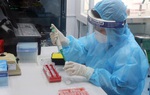 Bé 7 ngày tuổi dương tính với SARS-CoV-2