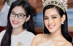 Đỗ Thị Hà công khai tu sửa hàm răng nhưng nhất định chối 1 bộ phận khác
