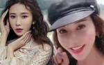Gương mặt Lâm Chí Linh cứng đờ vì tiêm botox "quá đà"