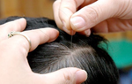 Tóc bạc sớm ở trẻ em: Nguyên nhân và biện pháp điều trị