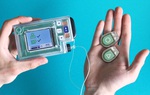 Sắp có tuyến tụy nhân tạo cho bệnh nhân tiểu đường
