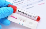 Kit test nhanh Covid-19: Mua loại nào, ở đâu đảm bảo? 