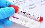 Bộ Y tế nói gì trước thông tin về test kit xét nghiệm Covid-19 ở Việt Nam cao hơn thế giới?