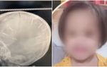 Hội LHPN TP Hà Nội thăm hỏi bé gái 3 tuổi bị người tình của mẹ đóng 9 chiếc đinh vào đầu