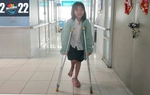 Cái chân bị gãy và nụ cười chưa bao giờ tắt trên môi cô bé 10 tuổi