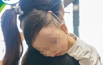 Cảnh báo của bác sĩ từ trường hợp sợi thép rây lọc cháo đâm xuyên amidan bé 13 tháng tuổi 