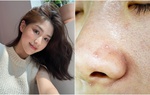 Tiêu chí lựa chọn kem chống nắng giúp nhân đôi khả năng bảo vệ da