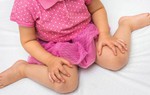 Hiểm họa không ngờ từ ngồi dáng chữ W hay gặp ở trẻ nhỏ