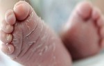 Bong tróc da tay chân ở trẻ em do đâu? Cha mẹ cần làm gì?