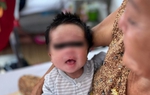 Cứu sống bé 16 ngày tuổi sốt cao, rốn lồi lên do mẹ không tiêm ngừa trong thai kỳ