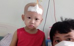 Bé gái 2 tuổi mắc bệnh hiểm nghèo không tiền cứu chữa