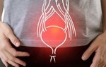 Tìm hiểu hội chứng bàng quang tăng hoạt vào mùa đông