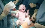 Con dâu suýt nguy kịch vì mẹ chồng không đồng ý cho bác sĩ nam phụ trách ca mổ đẻ