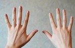 7 dấu hiệu ở tay cảnh báo sức khoẻ có vấn đề